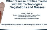 Other Disease Entities Treated With PE Technologies: Vegetations And Masses