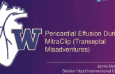 Effusion During Mitraclip: What Now?