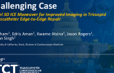 TCT 1283: Novel 3D ICE Maneuver for Improved Imaging in Tricuspid Transcatheter Edge-to-Edge Repair