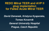 Redo Mitral TEER and AVP II Plug Implantation for Failed Acute Mitral TEER