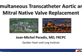 Simultaneous Transfemoral Aortic and Mitral Native Valve Replacement: A Step-by-Step Procedural Approach