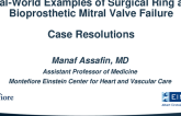 Case Resolution: Real-World Examples of Surgical Ring and Bioprosthetic Mitral Failure