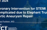 TCT 1111: Coronary Intervention for STEMI Complicated due to Elephant Trunk Aortic Aneurysm Repair