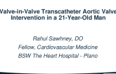 Valve-in-Valve Transcatheter Aortic Valve Intervention in a 21-Year-Old Man