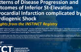 TCT 280: Patterns of Disease Progression and Outcomes of Inferior ST-Elevation Myocardial Infarction Complicated by Cardiogenic Shock: Insights From the INSTINCT Registry