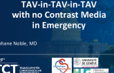 TCT 1591: TAV-in TAv-in TAV With No Contrast Media in Emergency 