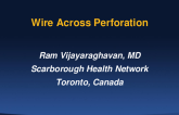 Wire Across: Perforation