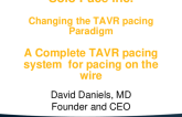 Left Ventricle Pacing Algorithm During TAVR (Solo Pace): Program Update