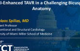 TCT 1325: Artificial Intelligence-Enhanced Transcatheter Aortic Valve Replacement in a Challenging Bicuspid Anatomy