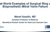 Case Presentation: Real-World Examples of Surgical Ring and Bioprosthetic Mitral Valve Failure