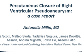 Percutaneous Closure of Right Ventricular Pseudoaneurysm: A Case Report
