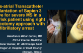 Trans-Atrial Implantation of Sapien 3 Valve for Severe MS in a High Risk Patient Using Right Thoracotomy Approach With Fibrillatory Arrest