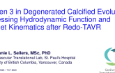 TCT 386: Sapien 3 in Degenerated Calcified Evolut: Assessing Hydrodynamic Function and Leaflet Kinematics After Redo-TAVR  