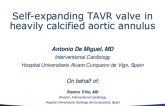 TCT 794: SELF-EXPANDING TAVR VALVE IN HEAVILY CALCIFIED AORTIC ANNULUS