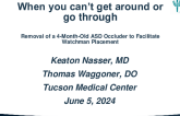 Removal of a 4-Month-Old ASD Occluder to Facilitate Watchman Placement