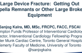 Large Device Fracture! Getting Out the Impella Remnants or Other Large Broken Equipment