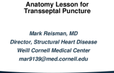An Anatomy Lesson for Transseptal Puncture