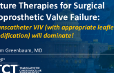 Transcatheter VIV (With Appropriate Leaflet Modification) Will Dominate!