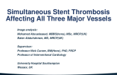 TCT 835: Simultaneous Stent Thrombosis Affecting All Three Major Vessels