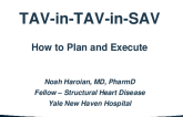 TAV-in-TAV-in-SAV: How to Plan and Execute