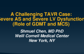 A Challenging TAVR Case: Severe AS and Severe LV Dysfunction (Role of GDMT and MCS)