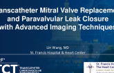 TCT 1348: Transcatheter Mitral Valve Replacement and Paravalvular Leak Closure With Advanced Imaging Techniques 
