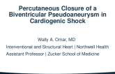 Percutaneous Closure of a Complex Pseudoaneurysm in Cardiogenic Shcock