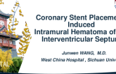 TCT 1086: Coronary Stent Placement-Induced Intramural Hematoma of the Interventricular Septum: A Rare Complication