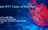 My Best DVT Case of the Year