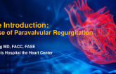 Case Introduction: A Case of Paravalvular Regurgitation