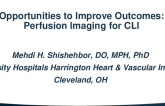 Opportunities to Improve Outcomes: Perfusion Imaging for CLI