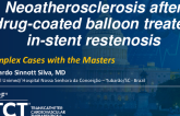 TCT 1322: Neoatherosclerosis After Drug-Coated Balloon Treated In-Stent Restenosis