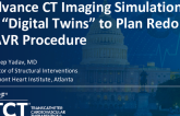 Advanced CT Imaging Simulations or “Digital Twins” to Plan Redo TAVR Procedures