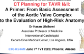 CT Planning for TAVR II:  High-risk Anatomy From Annular Calcification to Risk of Coronary Obstruction