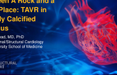Case 1: Between A Rock and a Hard Place: TAVR in Heavily Calcified Annulus