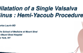 Aortic Valve Preservation – Single Sinus Pathology