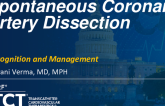 Spontaneous Coronary Artery Dissection: Recognition and Management