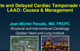 Acute and Delayed Cardiac Tamponade with LAAO: Causes & Management