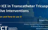 Intracardiac Echocardiography in TTVI - When and How to Use It