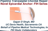 Transseptal Chordal Repair: One-Year Results From a First-In-Human Series (Pipeline Medical)