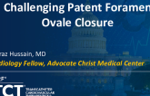 TCT 1475: Challenging Patent Foramen Ovale Closure