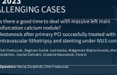 TCT 800: Is there a good time to deal with massive Left Main bifurcation calcium nodule? Case of restenosis after primary PCI of calcified lesion sucesfully trated with intravascular lithotrypsy and provissional stenting
