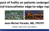 Impact of Frailty on Patients Undergoing Mitral Edge-to-Edge Repair