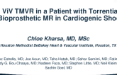 ViV TMVR in a Patient With Torrential Bioprosthetic MR in Cardiogenic Shock