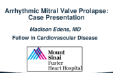 Case Presentation: Arrhythmic Mitral Valve Prolapse – Medication, Ablation, ICD or Surgery?