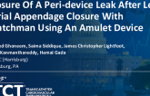TCT 1511: Closure of a Peri-Device Leak After Left Atrial Appendage Closure With Watchman Using an Amulet Device
