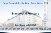 Putting Knowledge Into Practice: Demonstration of Transseptal Puncture