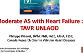 Moderate AS With Heart Failure: TAVR UNLOAD