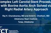 TCT 1191: Complex Left Carotid Stent Procedure With Bovine Aortic Arch Solved via Right Radial Artery Approach