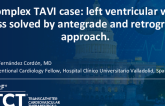 TCT 1454: Complex TAVI Case: Left Ventricular Wire Loss Solved by Antegrade and Retrograde Approach